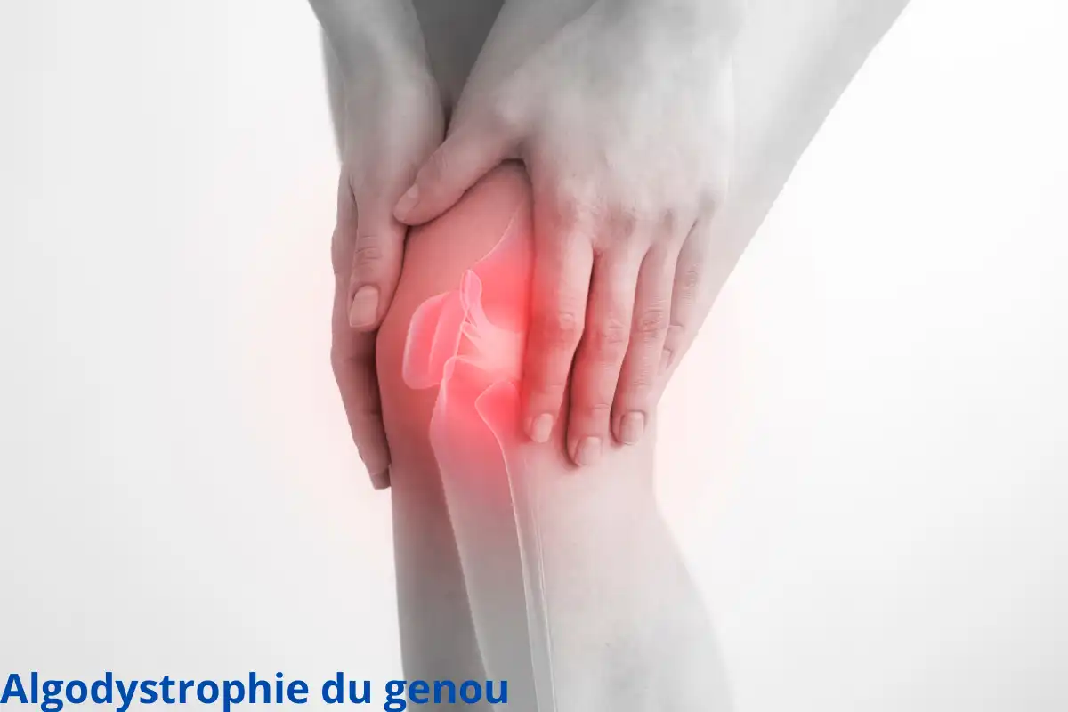 Algodystrophie du genou